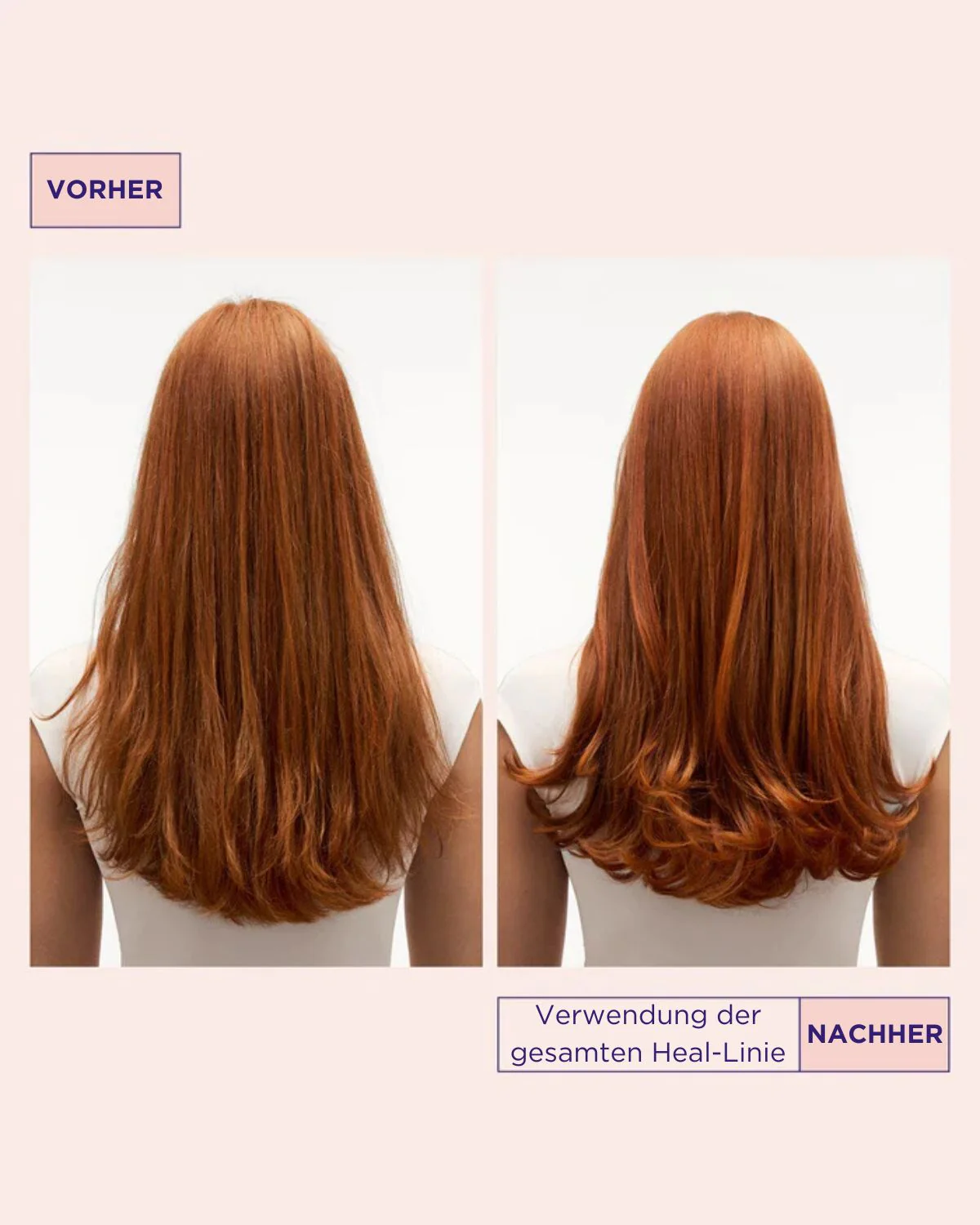 Head & Hair Heal Care Duo - Image 4